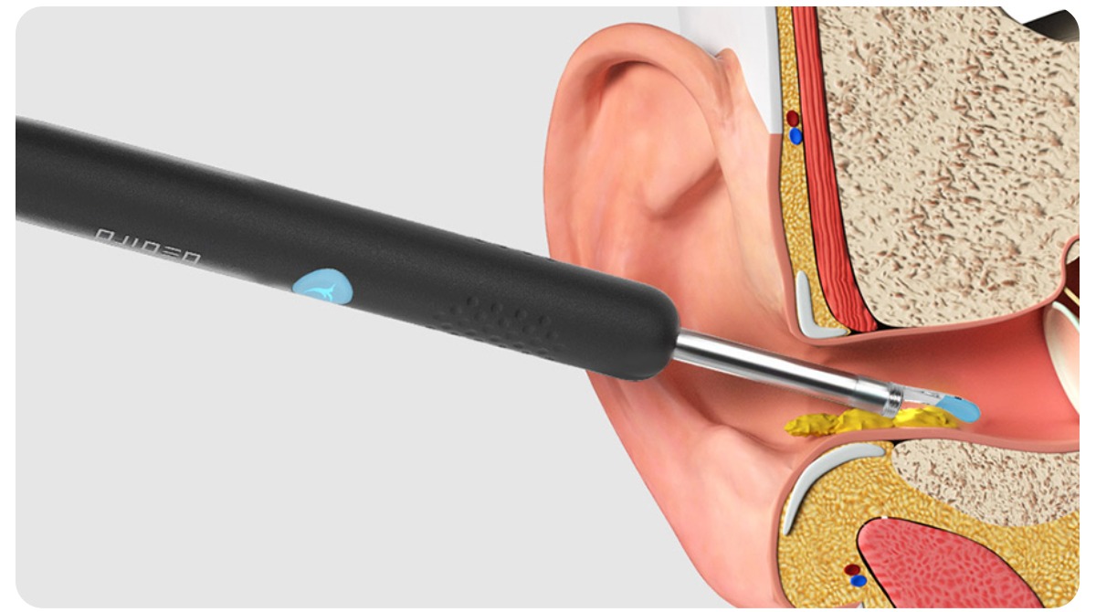 Bebird-Smart-Visual-Ear-Rod-R1-02