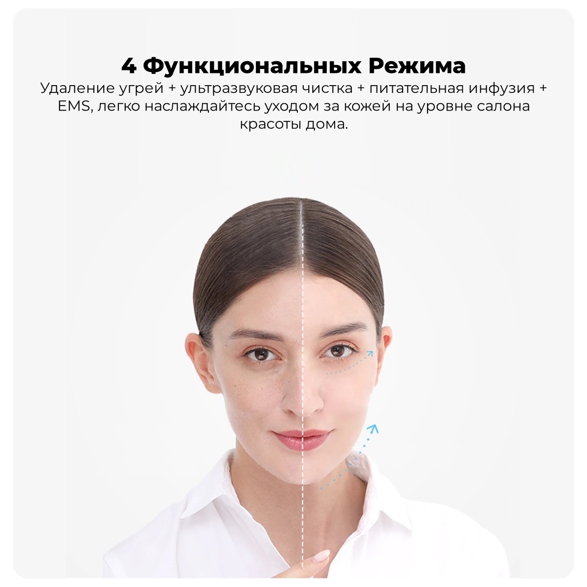 XiaoMi-InFace-Blackhead-Remover-MS7100-03