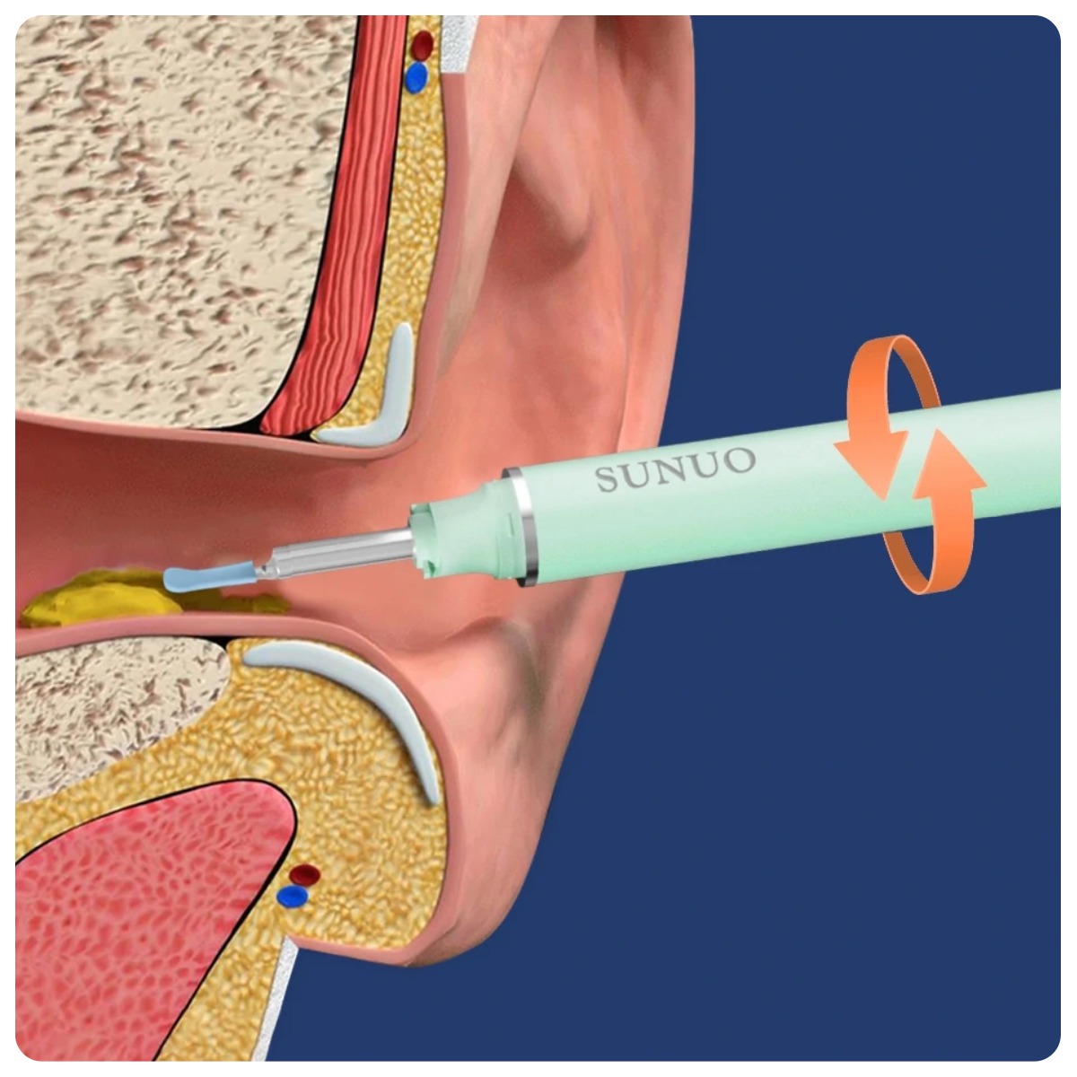 XiaoMi-Sunuo-Find-X-04